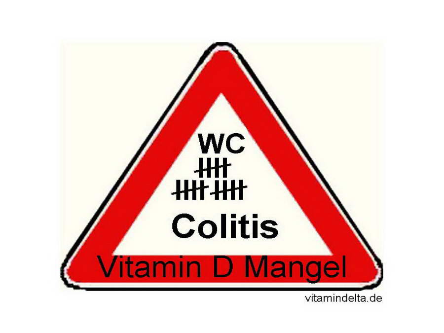 Risiko-Colitis-Risiko-Vitamin-D-Mangel.jpg